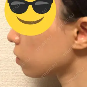 リッツ美容外科の口コミ