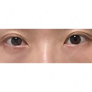 口コミ