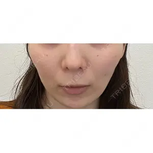 まゆりなclinic 名古屋栄口コミ
