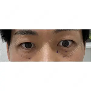東京形成美容外科の口コミ