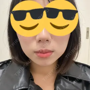 口コミ