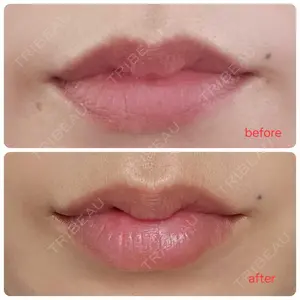 AZ BEAUTY CLINIC口コミ