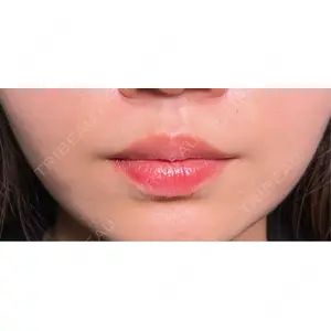 HAAB×DREAM BEAUTY CLINIC HAAB×DREAM BEAUTY CLINIC 大阪梅田院口コミ
