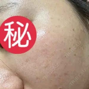 ルラ美容クリニック ルラ美容クリニック 池袋院口コミ