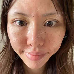 湘南美容クリニック 池袋西口院口コミ