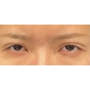 口コミ