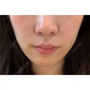EMMO FACE CLINIC EMMO FACE CLINIC 大宮院口コミ