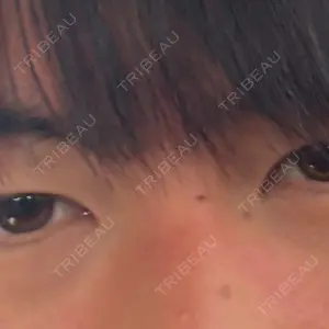 HAAB×DREAM BEAUTY CLINIC HAAB×DREAM BEAUTY CLINIC 大阪梅田院口コミ