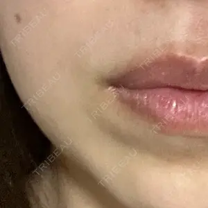 東京BELLEZZAクリニック口コミ