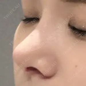 東京シンデレラ美容外科 新宿院口コミ