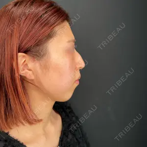 HAAB×DREAM BEAUTY CLINIC HAAB×DREAM BEAUTY CLINIC 大阪梅田院口コミ
