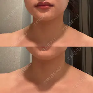 BiBiクリニック口コミ