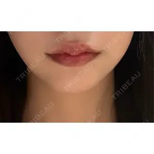 PRO CLINIC プロクリニック 銀座院口コミ