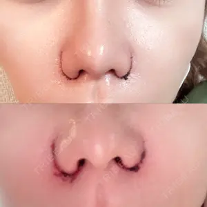 東京形成美容外科 東京形成美容外科 船橋院口コミ