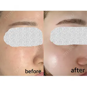 L‘amour clinic Tokyo【ラムールクリニック東京】口コミ