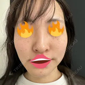 口コミ