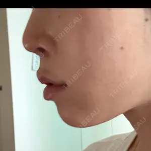 PRO CLINIC プロクリニック 銀座院口コミ