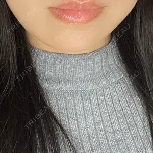 プライベートスキンクリニック 梅田本院口コミ