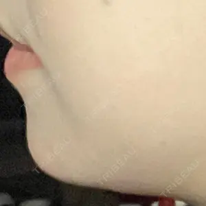 プライベートスキンクリニック 梅田本院口コミ