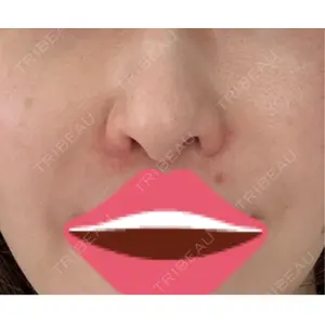 リッツ美容外科の口コミ