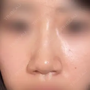 口コミ