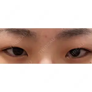 口コミ