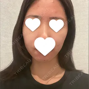 ウィルビークリニック 立川院口コミ