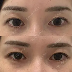 Brandnew Beauty Clinic口コミ