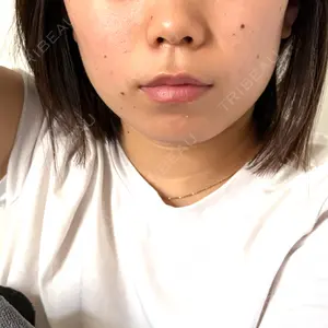 口コミ