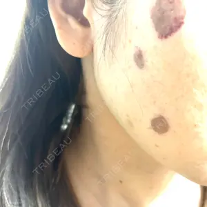 APスキンクリニック銀座口コミ