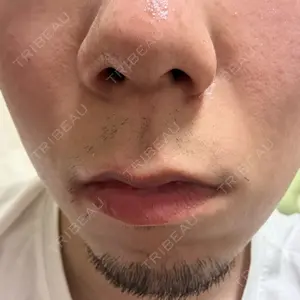 口コミ