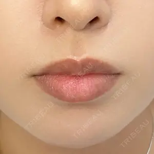 ルラ美容クリニックの口コミ
