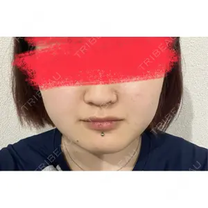 口コミ