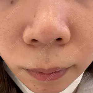 ルラ美容クリニック ルラ美容クリニック 札幌本院口コミ