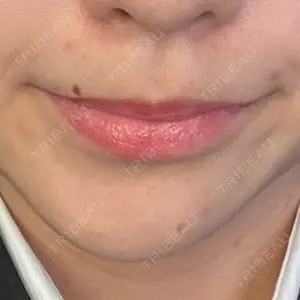 APスキンクリニック銀座口コミ