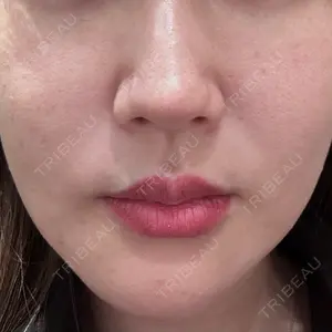 PRO CLINIC プロクリニック 銀座院口コミ
