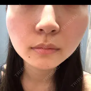 TCB東京中央美容外科 TCB東京中央美容外科 堺院口コミ