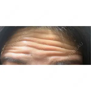 TCB東京中央美容外科 TCB東京中央美容外科 大宮東口院口コミ