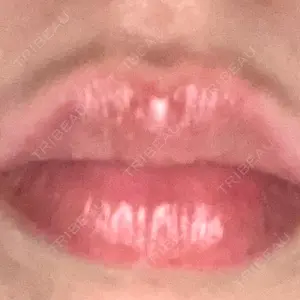 口コミ