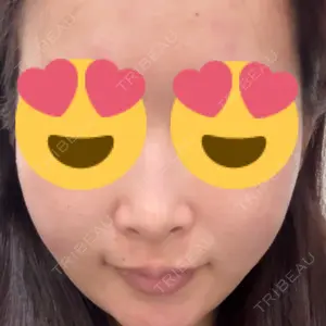 ルラ美容クリニック 池袋院口コミ