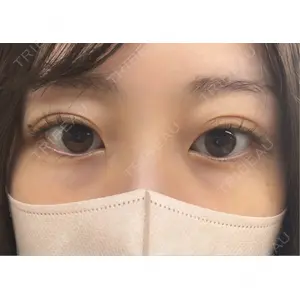 フィラークリニック フィラークリニック 大阪心斎橋院口コミ