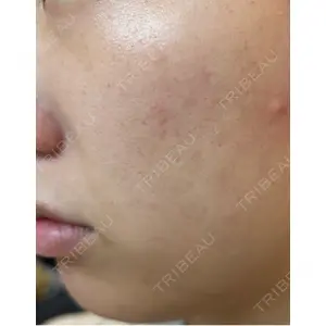 L‘amour clinic Tokyo【ラムールクリニック東京】口コミ