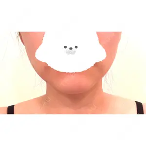 口コミ