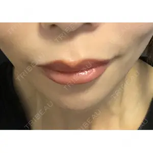 HAAB×DREAM BEAUTY CLINIC 東京本院の