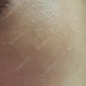 ハナビューティークリニック口コミ