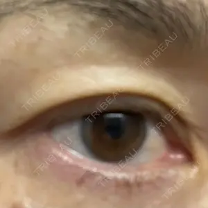 TCB東京中央美容外科 TCB東京中央美容外科 自由が丘院口コミ