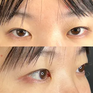藤・ナチュレ美容クリニックの口コミ
