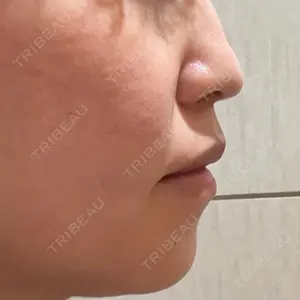 口コミ