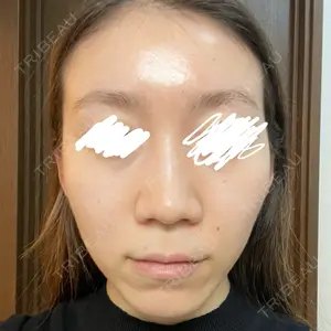 口コミ