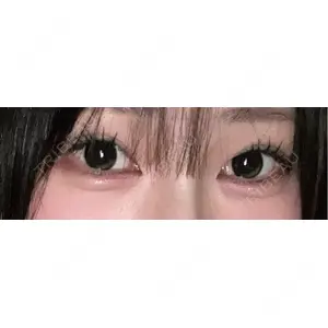 口コミ